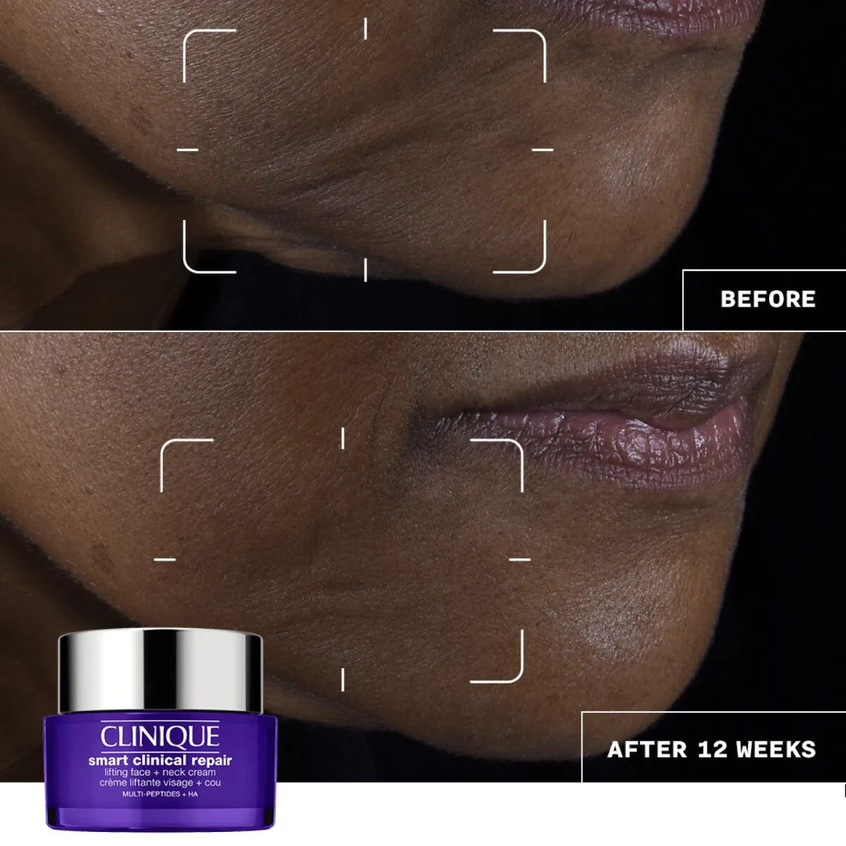 Clinique Smart Clinical Repair krema za lifting lica i vrata