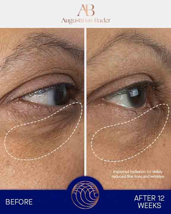 Augustinus Bader Augenpflege The Eye Cream Complete Set