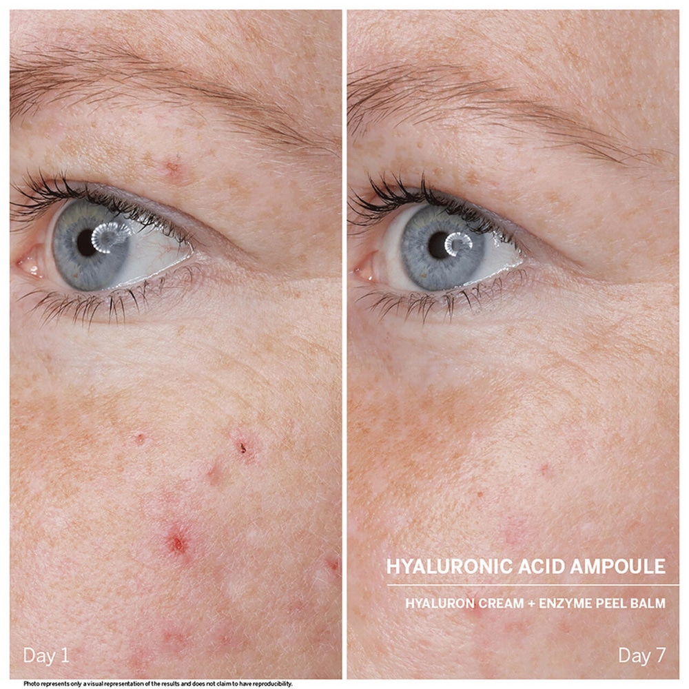 BABOR Hyaluronic Acid Power Serum Ampoules Sérum