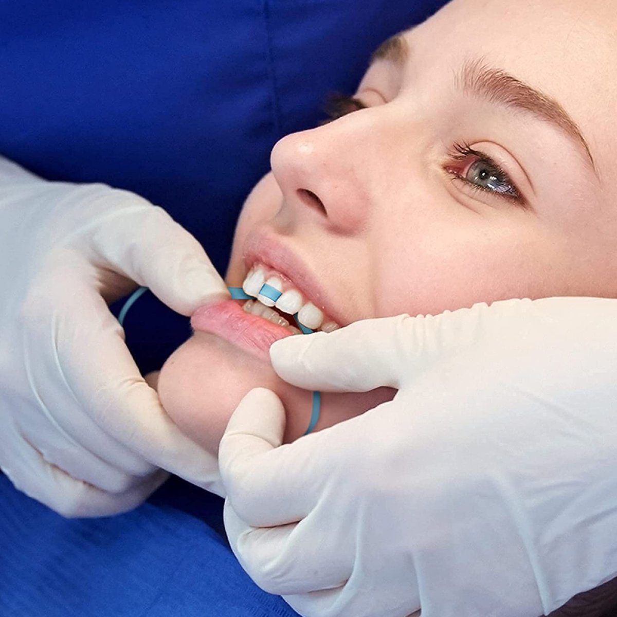 Rwoythk Zahnbleaching-Paste Zahn Schleifpapier, Dental Polierstreifen, Size - 30/50μm Breite