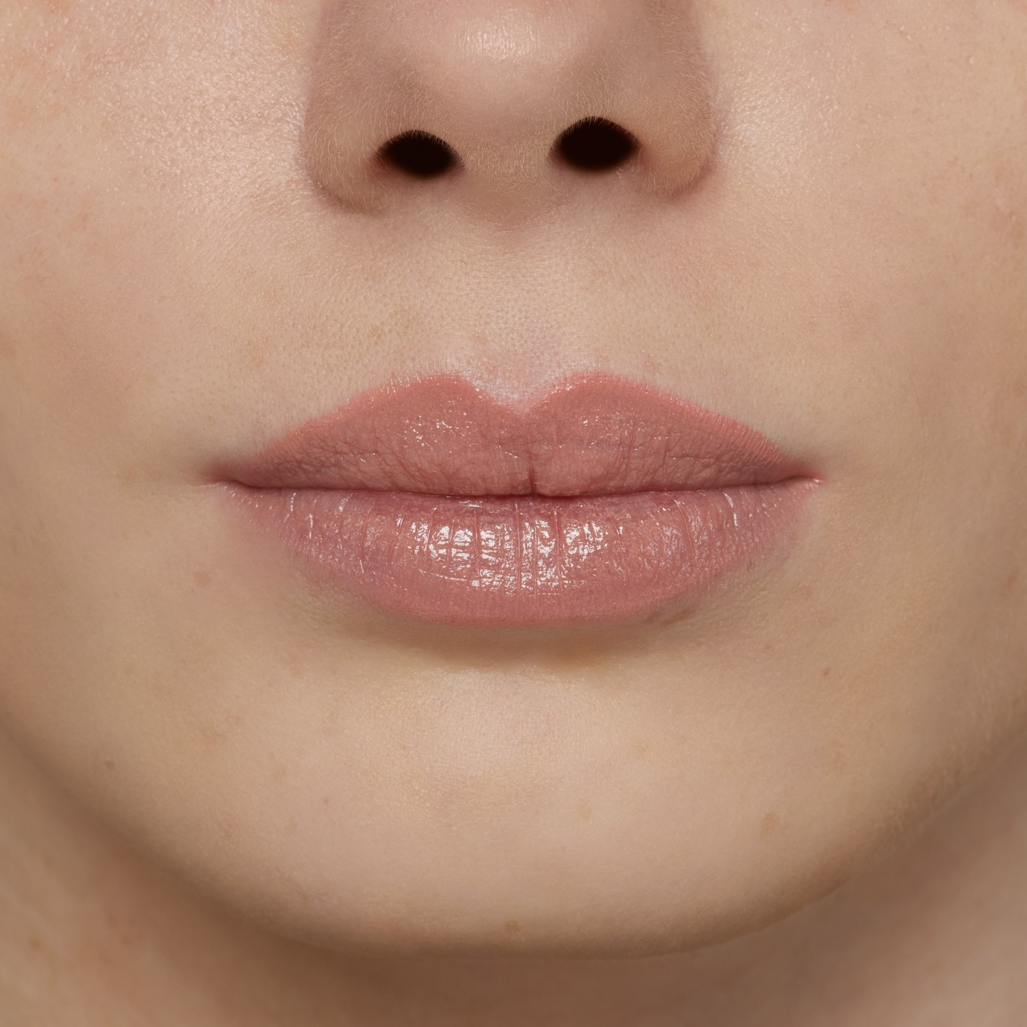 Hyaluronic