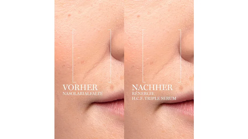 LANCÔME Rénergie H.C.F. Triple Serum 50 ml