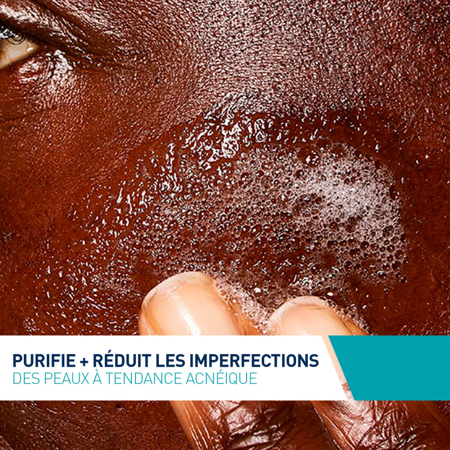Cerave Anti-Imperfections Gel Moussant - Peaux à Tendance Acnéique - 236 ml