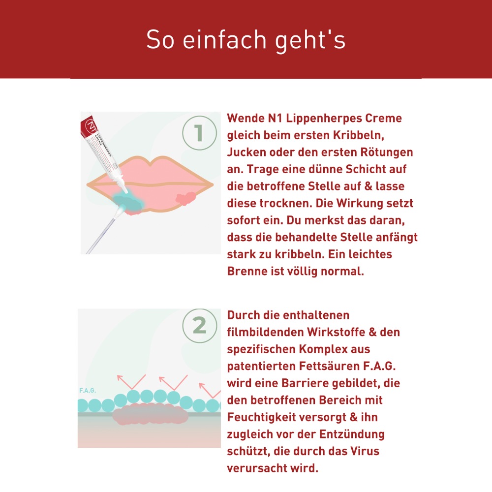 LIPPENHERPES Creme