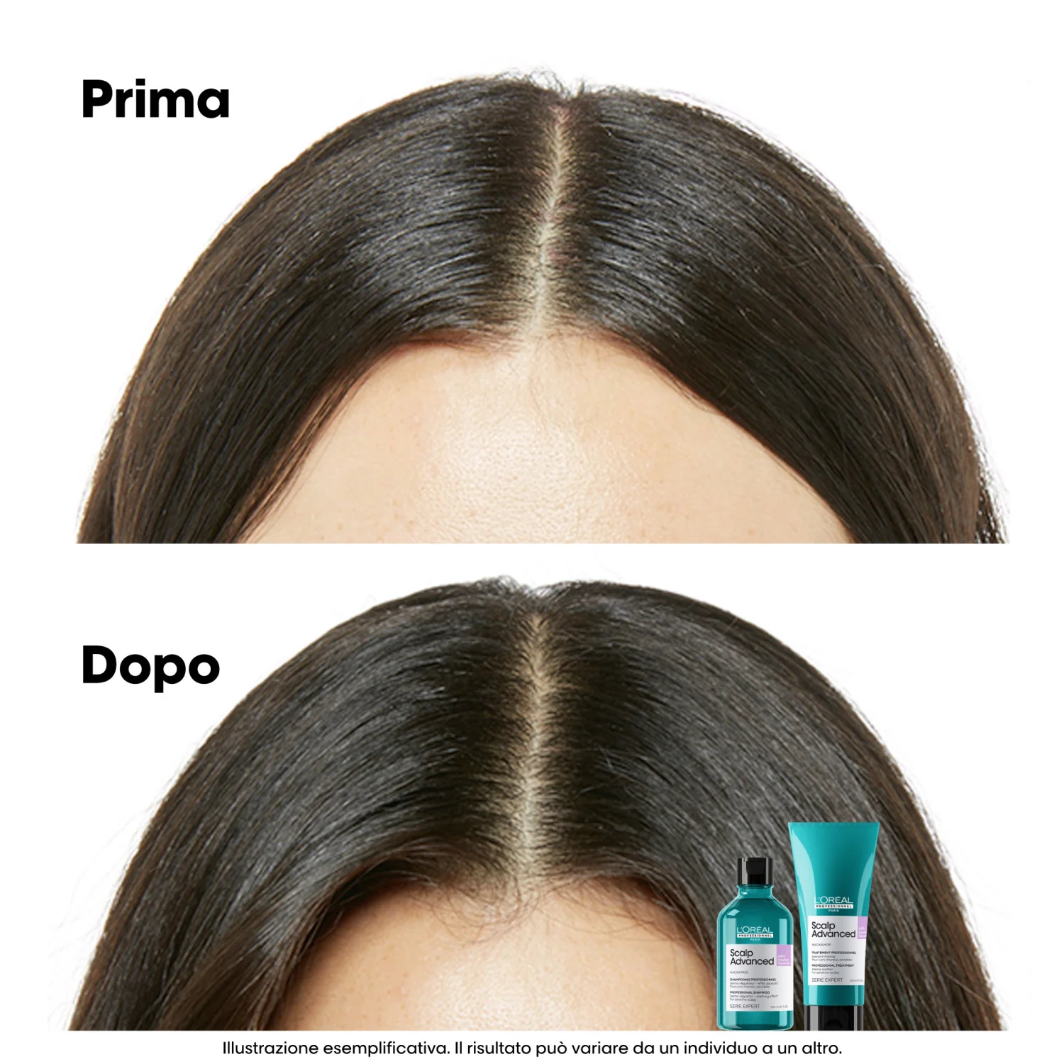 EXPERT SERIES New Scalp Advanced Anti-Discomfort Shampoo - Nachfüllpackung - Reinigendes Shampoo, Entgiftendes Shampoo