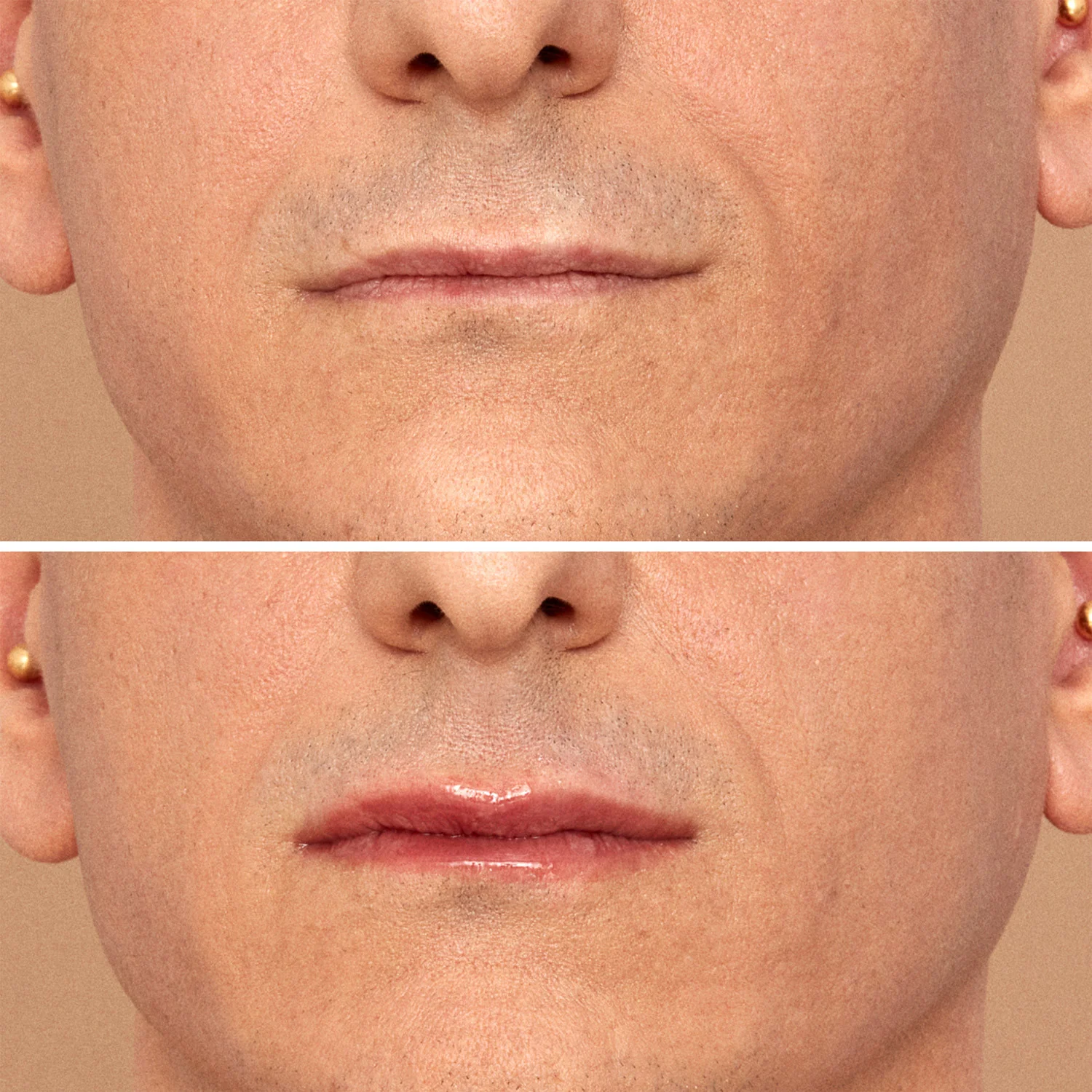 Viper Lip Plumper - Punjenje usana