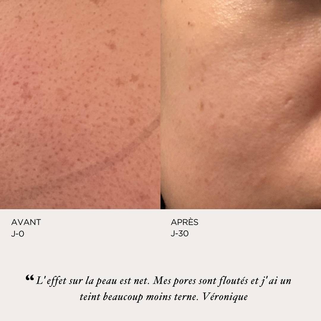 ORYZA LAB Peeling perfecteur