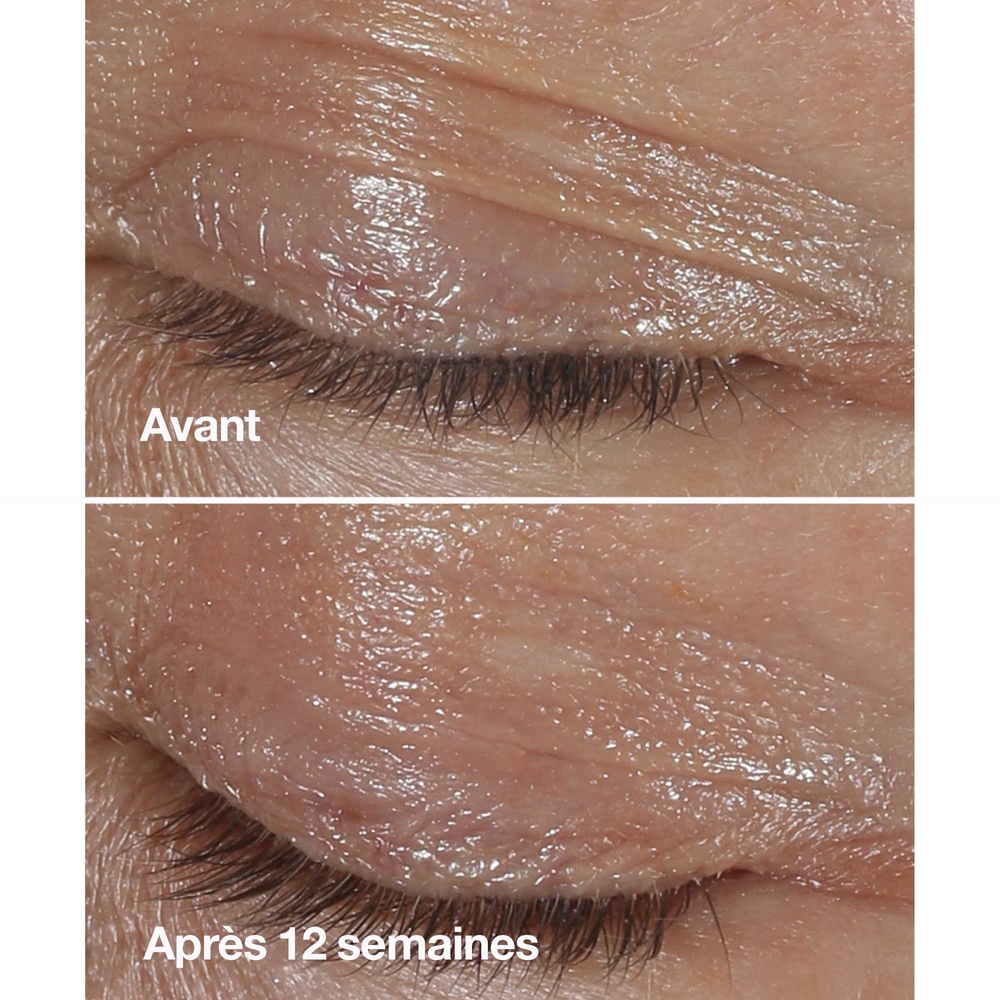 Clinique Smart Clinical Repair - Crème Yeux Correction Rides Contour des yeux anti-rides