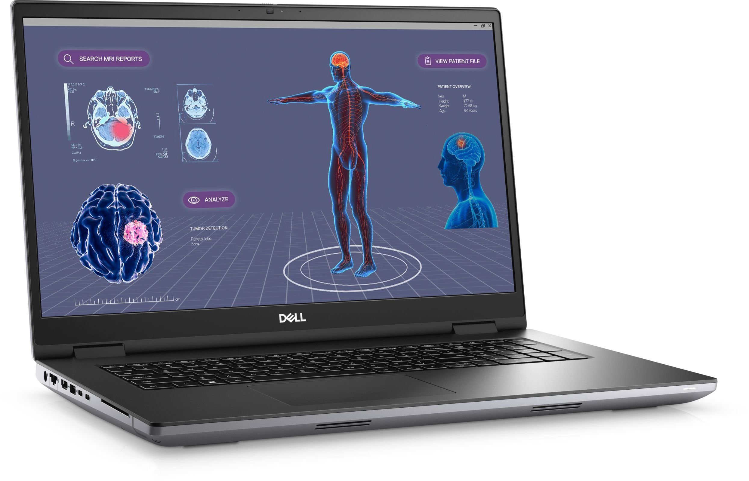 Dell Precision 7780 - 43.2 cm (17) - Intel Core i7-13850HX - Grau Notebook (Intel Core i7 13. Gen i7-13850HX, NVIDIA GeForce RTX 3500, 1000 GB SSD)