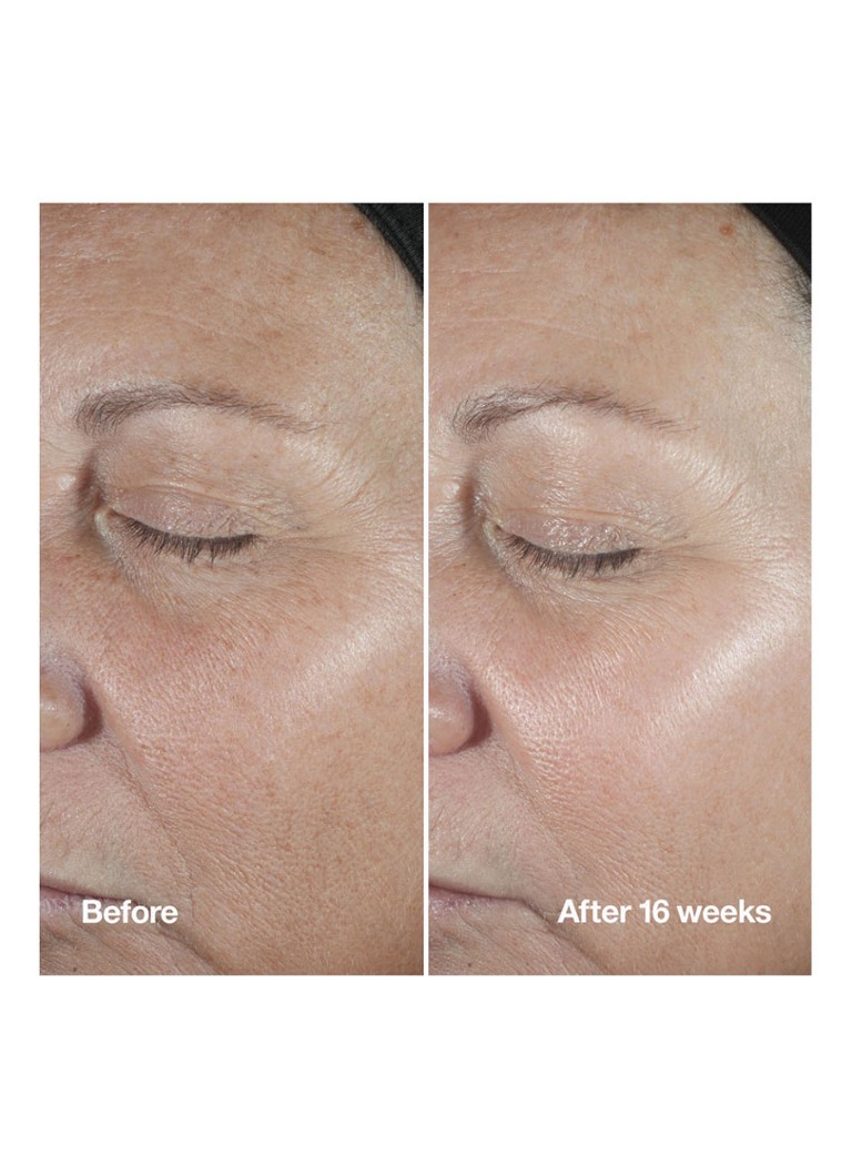 CLINIQUE Smart Clinical Repair™ Ορός Διόρθωσης Ρυτίδων – Ορός Περιορισμένης Έκδοσης