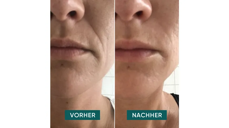 APRICOT Hyaluron Mund Pads