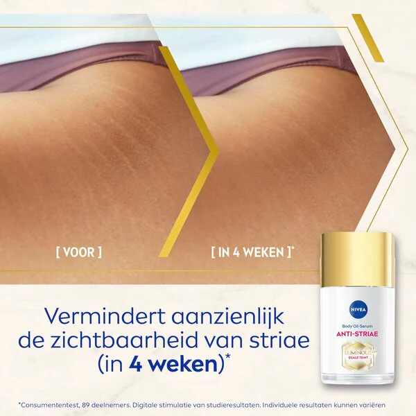 NIVEA Luminous630 Telové olejové sérum proti striám/striám 100 ml