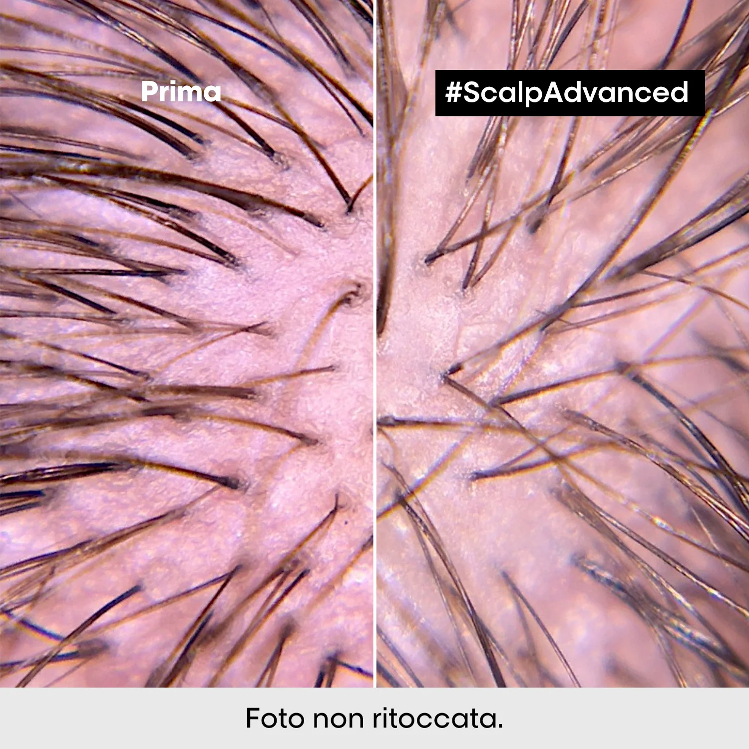 Serie Expertos: Nuevo tratamiento calmante intensivo avanzado para el cuero cabelludo - Acondicionador purificante para el cabello