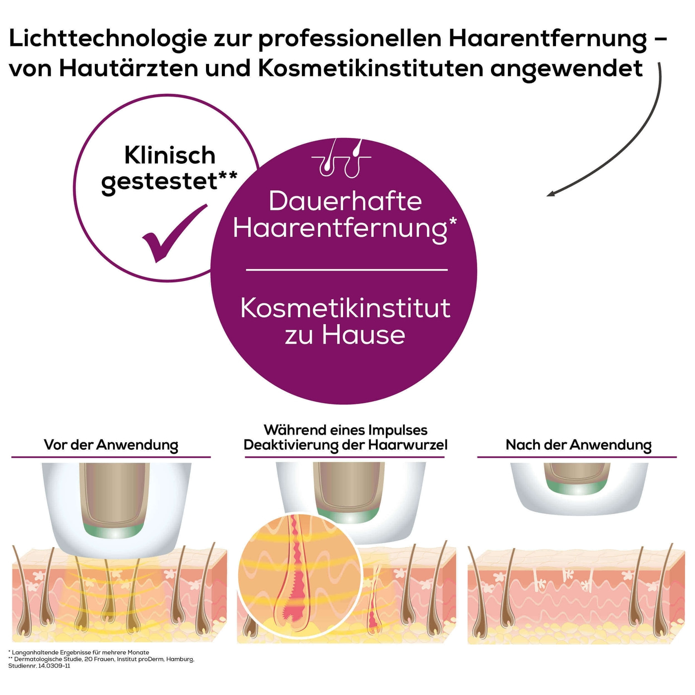 Beurer dauerhafte Haarentfernung IPL VelvetSkinPro Black-IPL Haarentfernungsgerät mit integriertem Akku