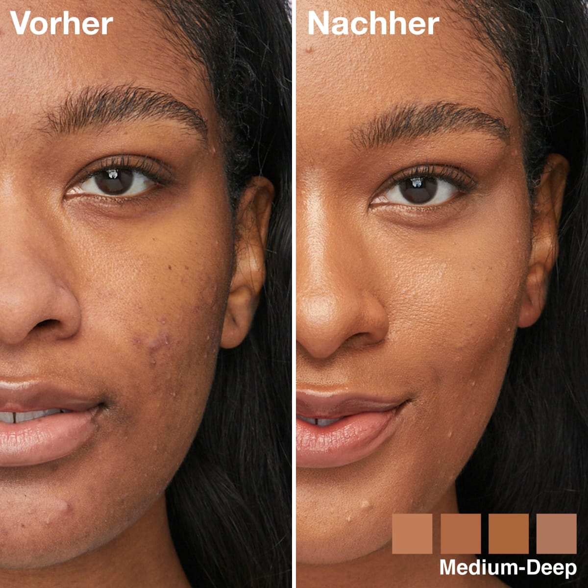 Foundation Instant Perfector Glow 4in1, 03 Medium-Deep, 20 ml