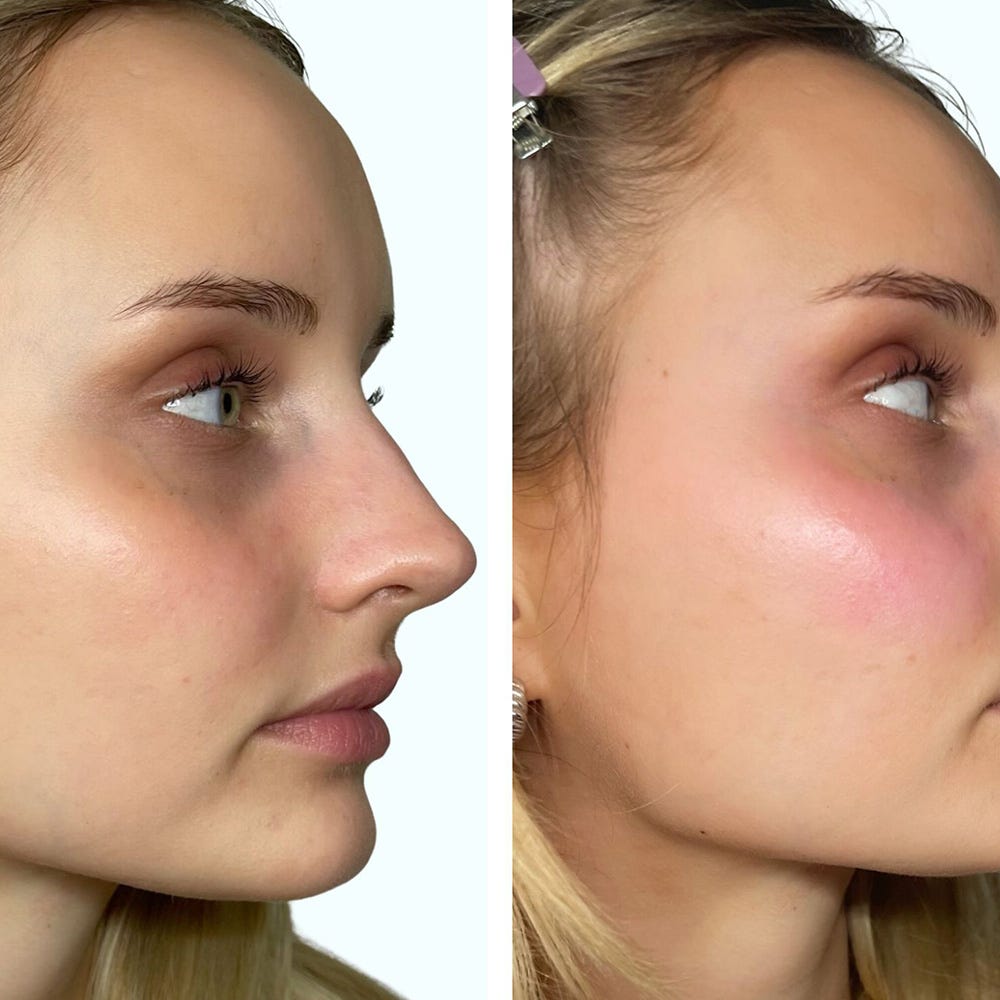 Venicebody PH-Activated Blush Stick Lip & Cheek 6,2 g