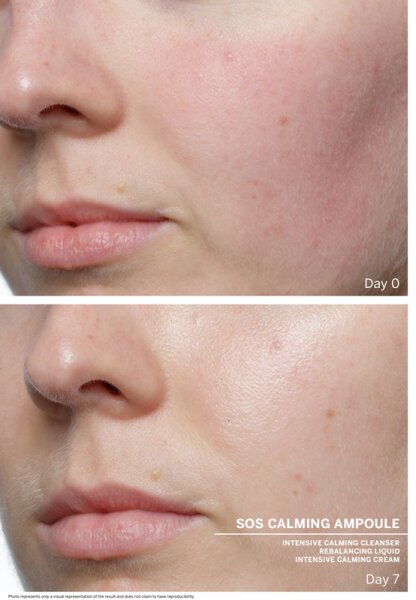 BABOR Ampoule Concentrates SOS Calming Ampullen