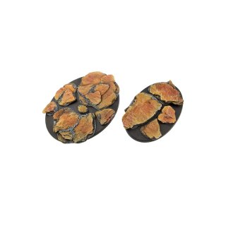 Shale - Basing Kit (15)