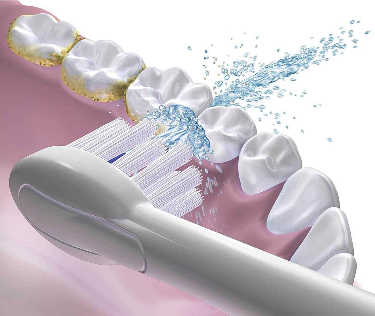 Waterpik Sonic-Fusion Zahnbürste mit integrierter Munddusche, 2-Minuten Timer   2 Bürsten