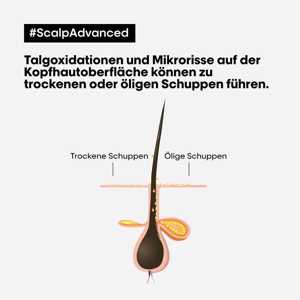 L&'Oréal Professionnel Serie Expert Scalp Advanced Anti-Dandruff Dermo-Clarifier Shampoo