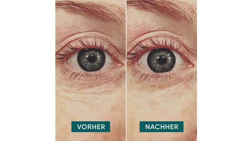 APRICOT Hyaluron Augen Pads