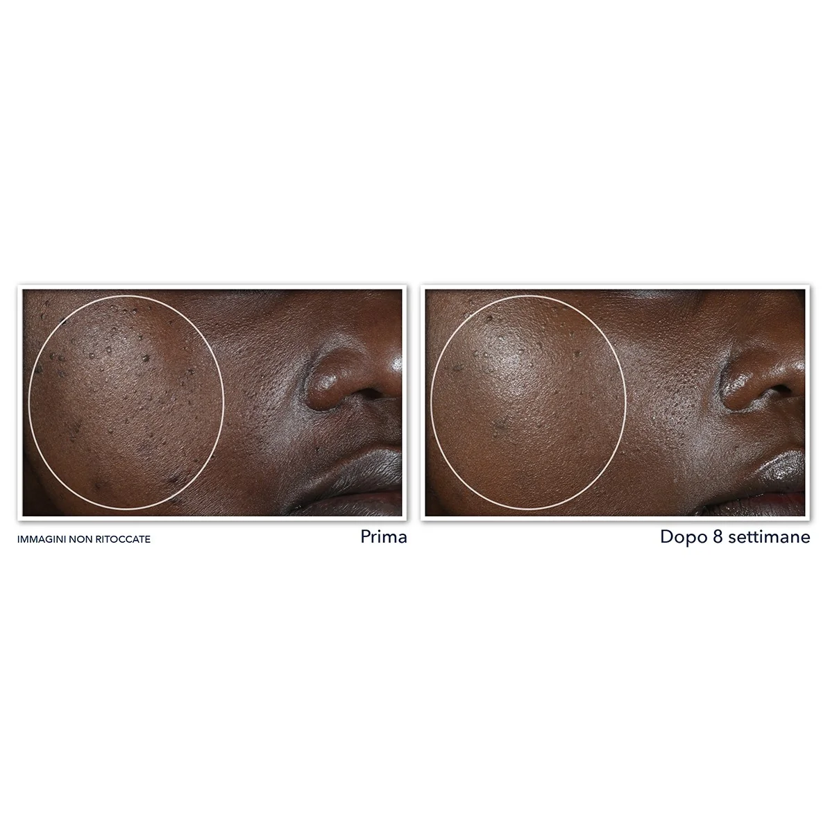 Multi Correxion Even Tone + Lift éjszakai krém - Lifting éjszakai kezelés, Ragyogó éjszakai kezelés, Pattanás elleni éjszakai kezelés, Tökéletlenségek elleni éjszakai kezelés