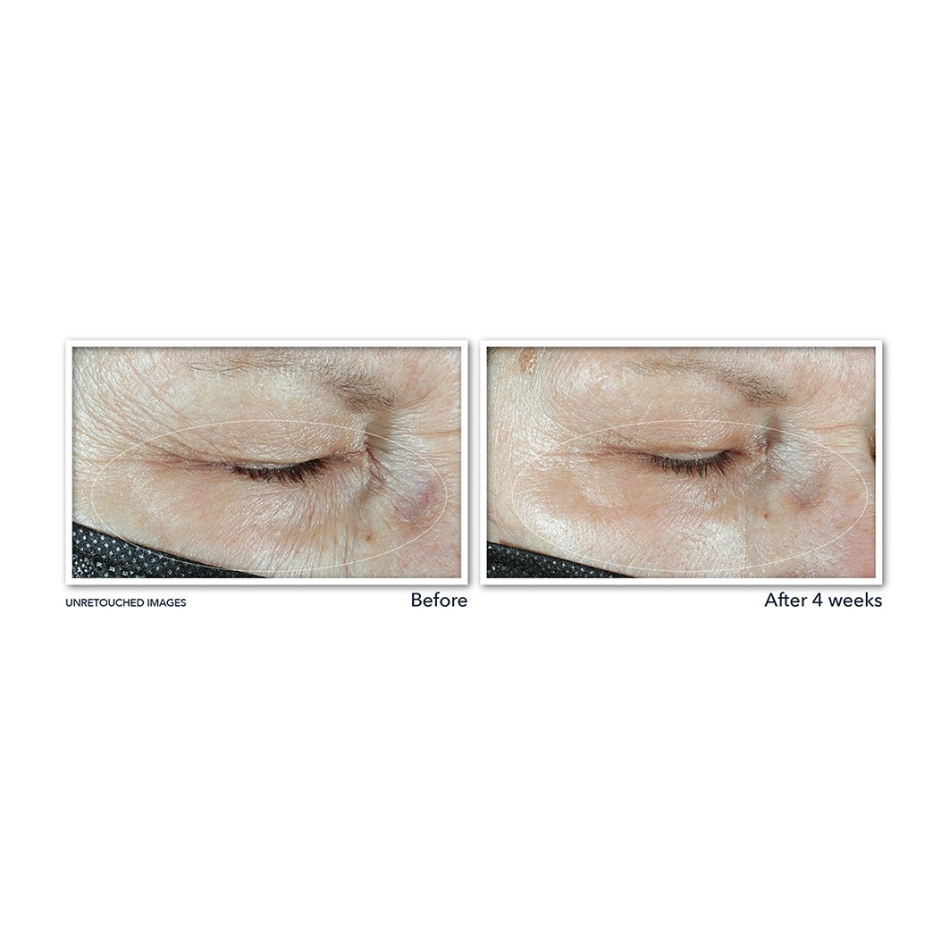 RoC Hydrate + Plump Eye Cream