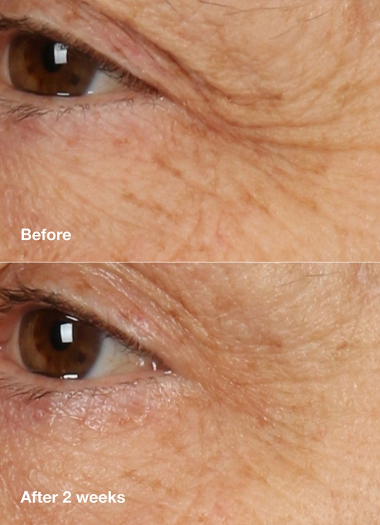 CLINQUE Smart Clinical Repair™ Crema Riparatrice Notte + Maschera Notte