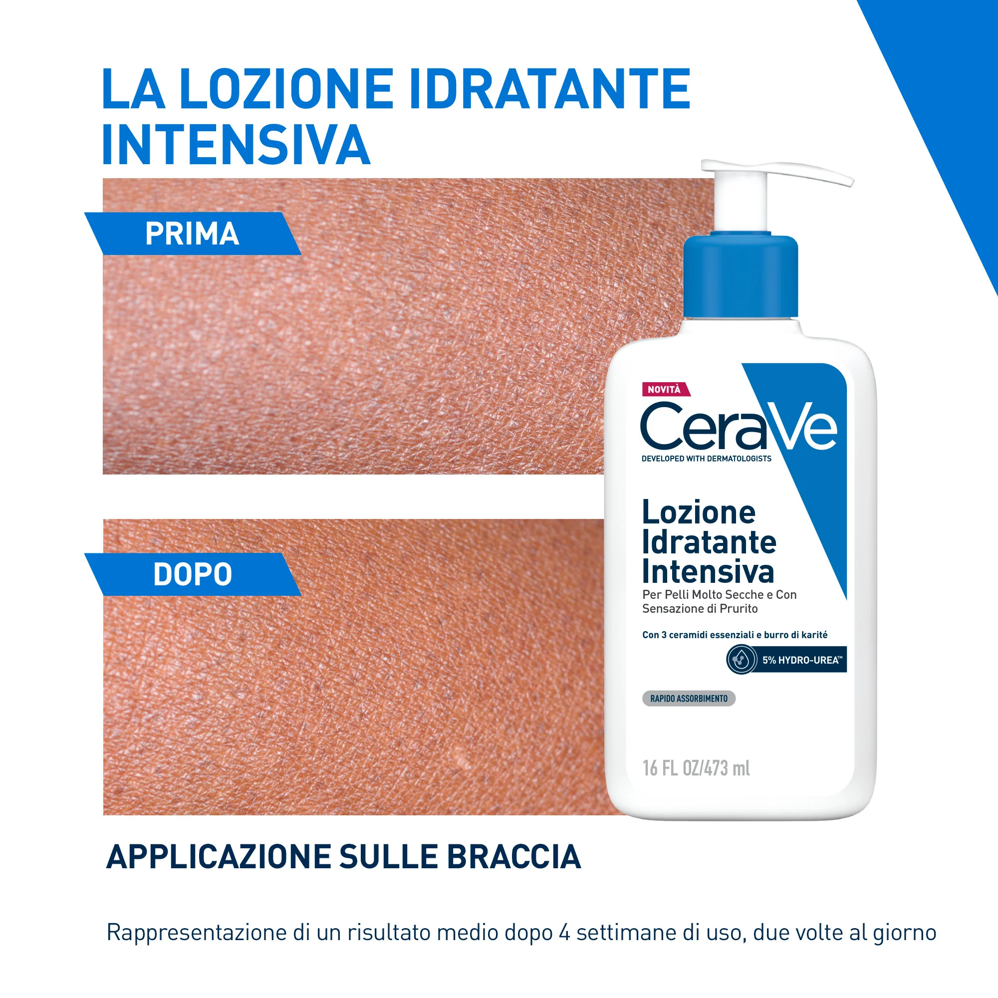 Loção Hidratante Intensiva para Pele Seca e Muito Seca - Creme Corporal, Tratamento Facial Hidratante 24 Horas