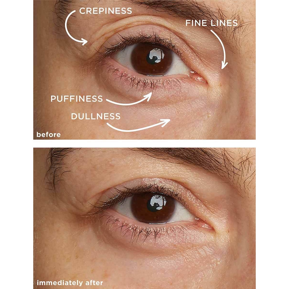 Lancer Eye Contour Lifting Cream soin des yeux
