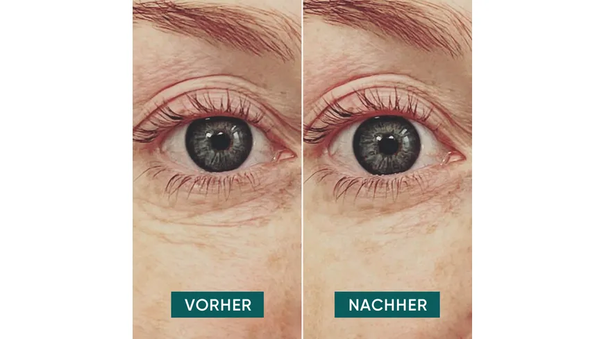 APRICOT Hyaluron Augenpads Glitzer