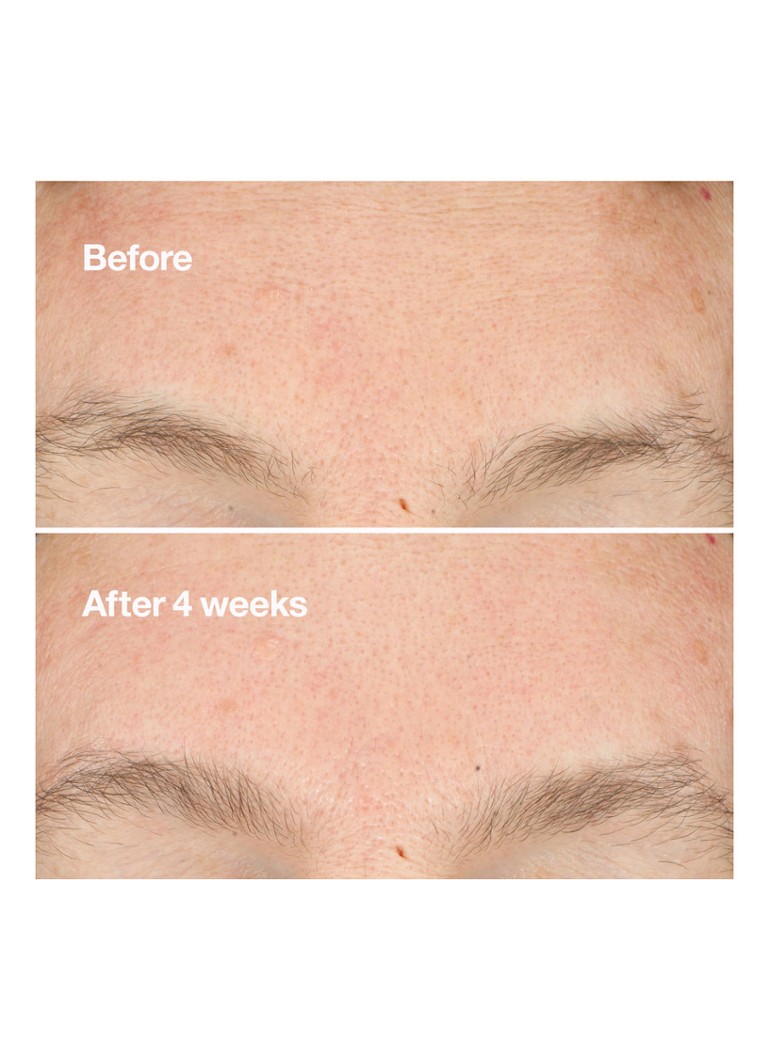 CLINIQUE Do-Over Clarifying Peel - peeling