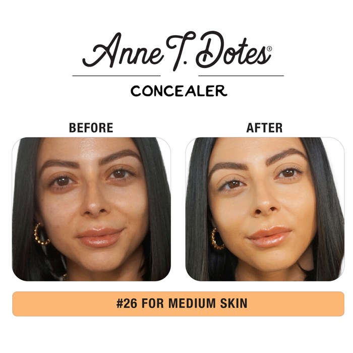 Anne T. Dote Concealer