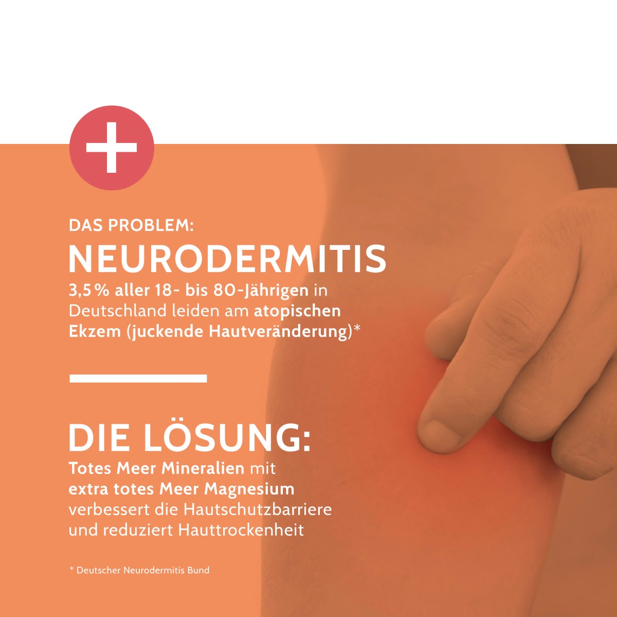 Pflegecreme Neurodermitis Salbe Totes Meer Therapie, 75 ml