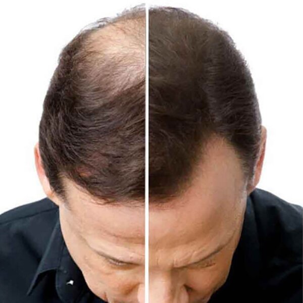 Natucain Hair Activator Haarserum