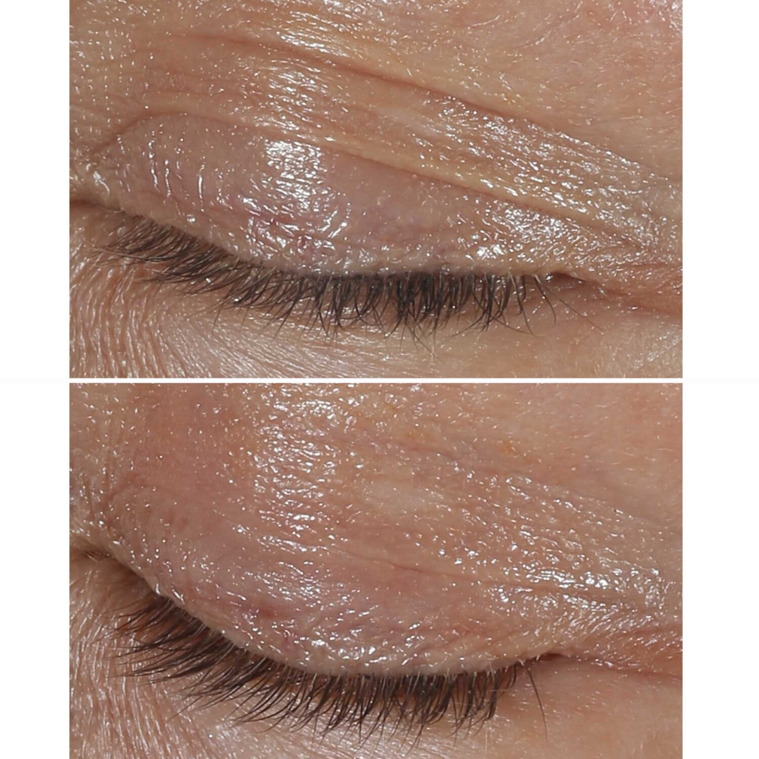 Clinique Clinique Smart Clinical Repair Crème Yeux Correction Rides 15 ml