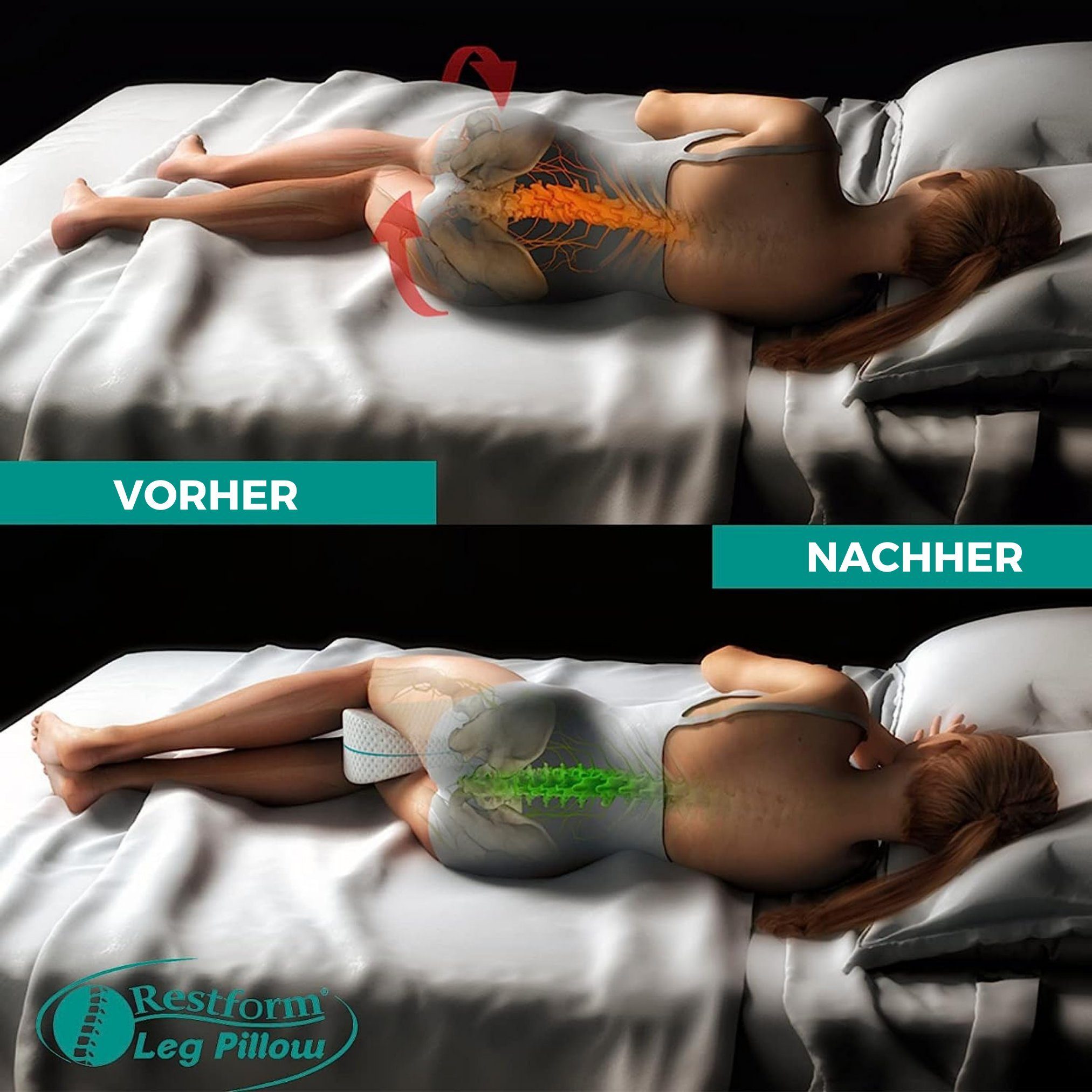 Restform® Seitenschläferkissen Leg Pillow ergonomisches Knie- und Beinruhekissen, Spar-Set, 1-tlg., Orthopädisches Beinkissen aus Memory-Schaum, Seitenschläferkissen