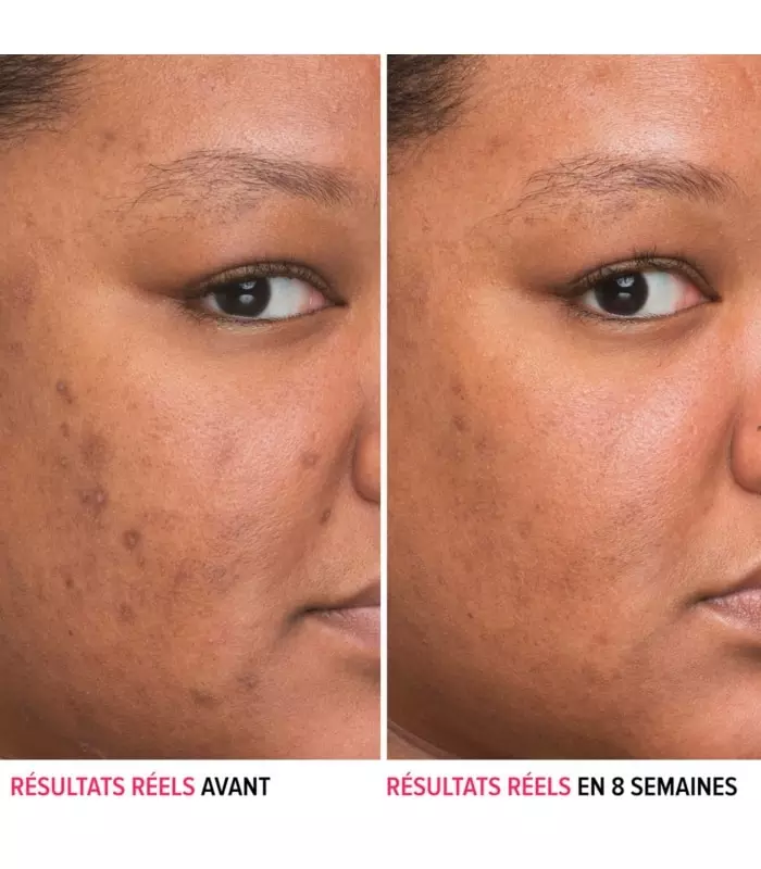 SERUM BYE BYE DARKSPOTS Sérum anti-taches à la niacinamide