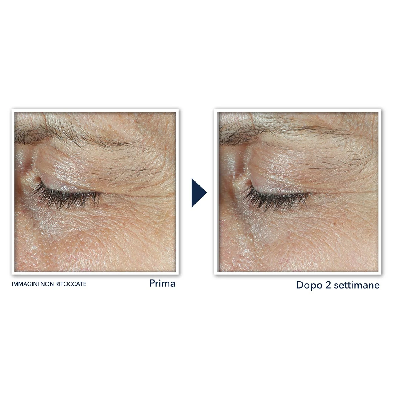 Derm Correxion Eye Contour Cream - Krém proti vráskam v oblasti očí