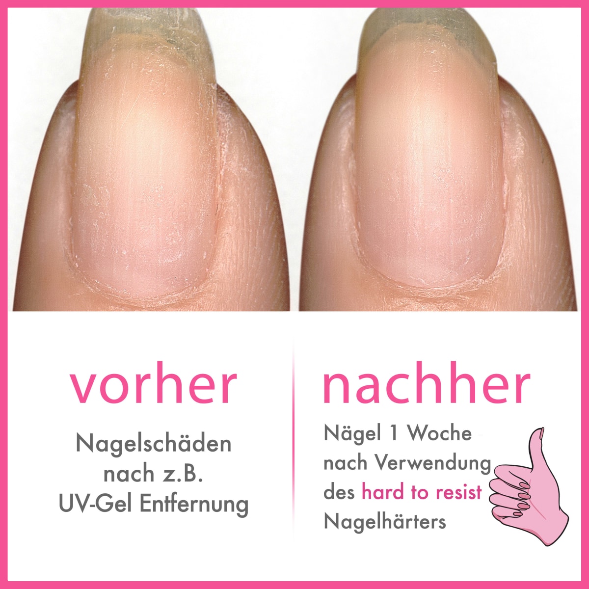 Nagelhärter Hard To Resist, 13,5 ml