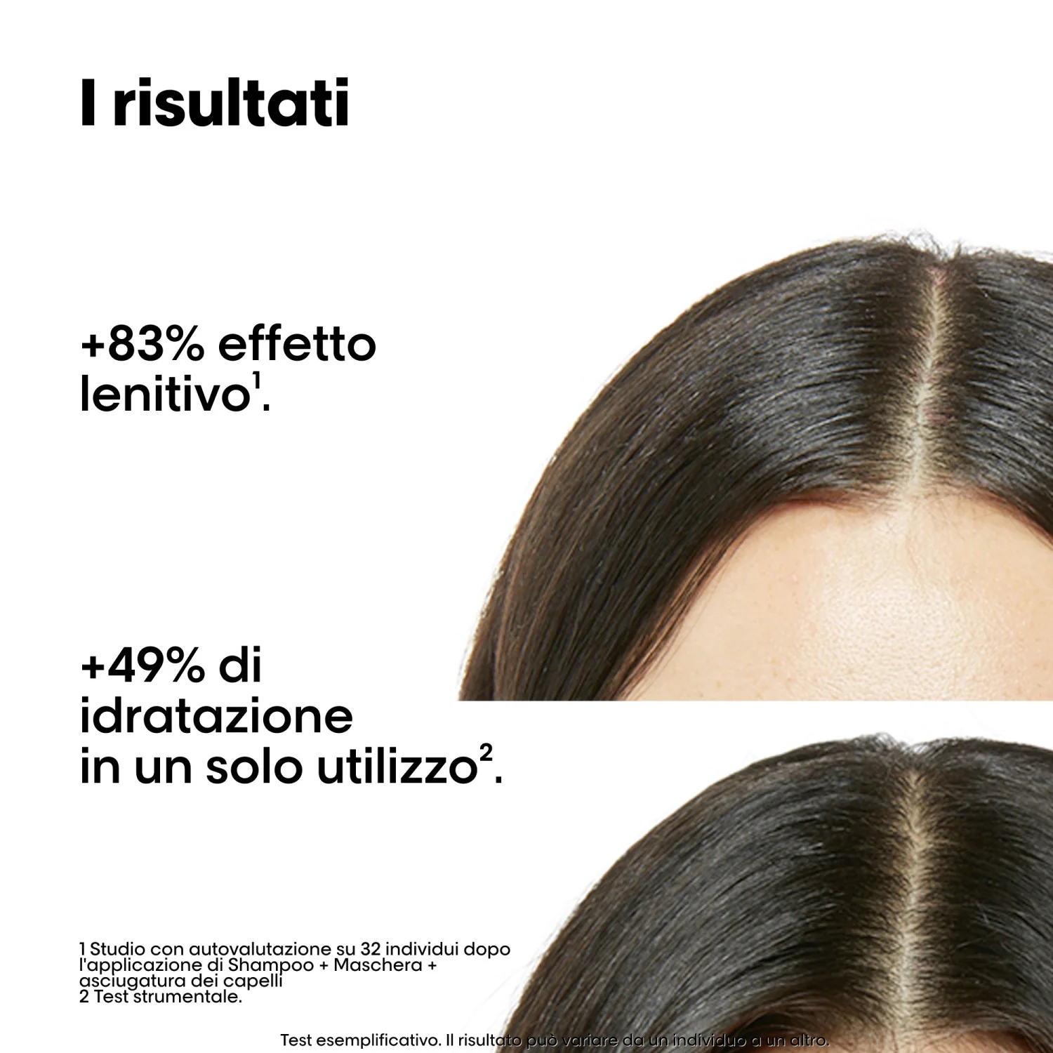 EXPERT SERIES New Scalp Advanced Anti-Discomfort Duo karácsonyi ajándékkészlet - Hajápolási ajándékkészletek