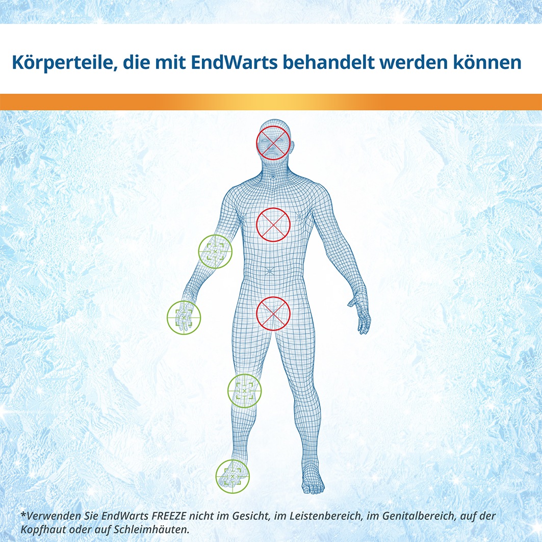 ENDWARTS Freeze