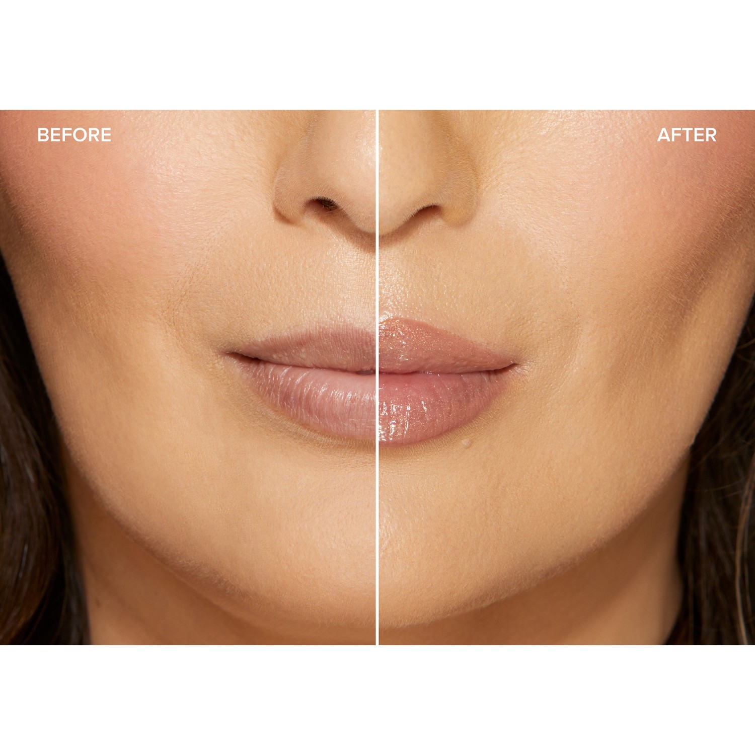 Lip Injection Maximum Plump