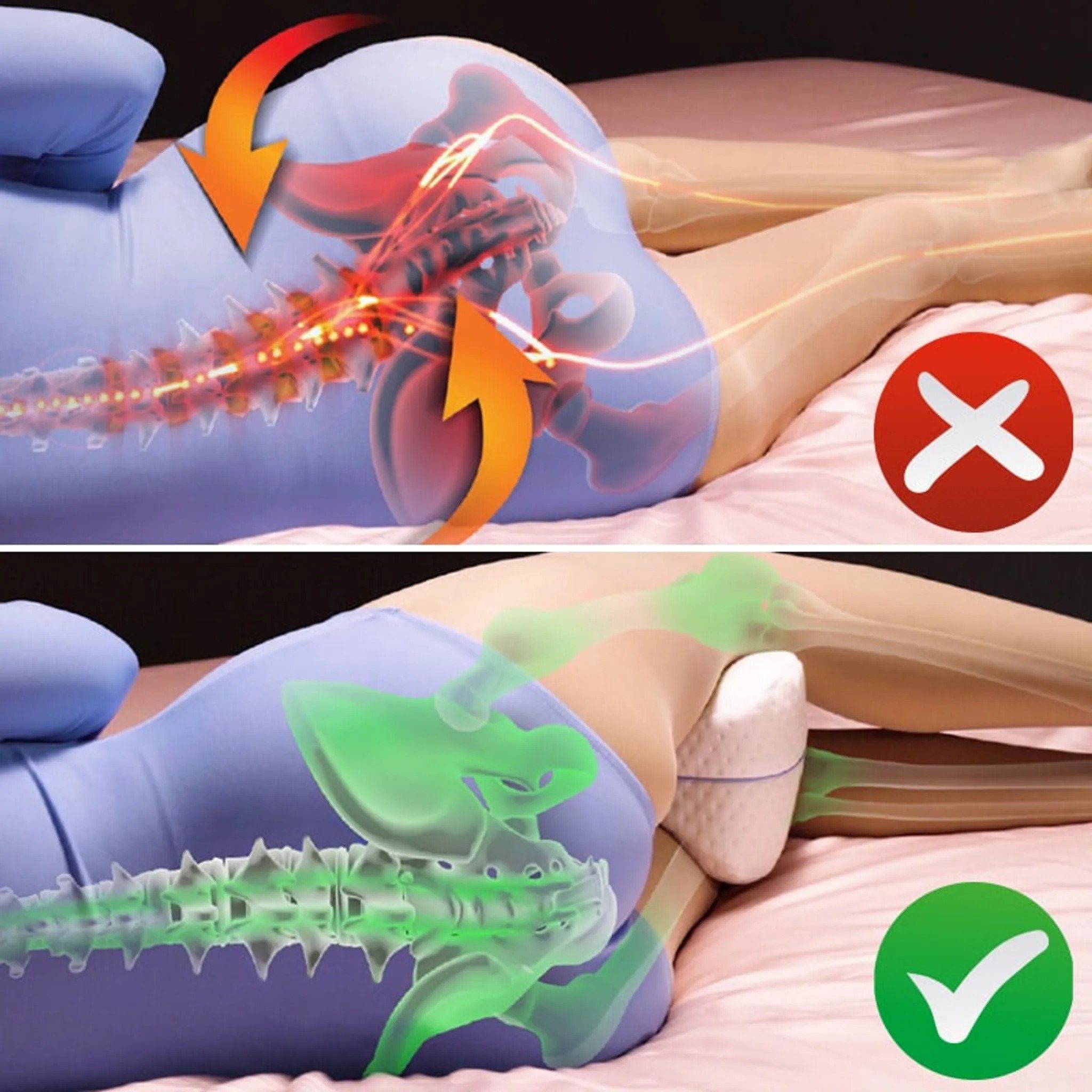 EBUY Seitenschläferkissen Leg Pillow Komfort für Seitenschläfer ergonomisches Knie, 1-tlg.
