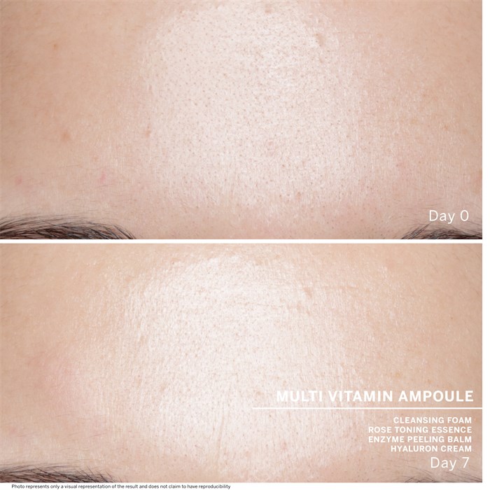Multi Vitamin 7 Ampoules
