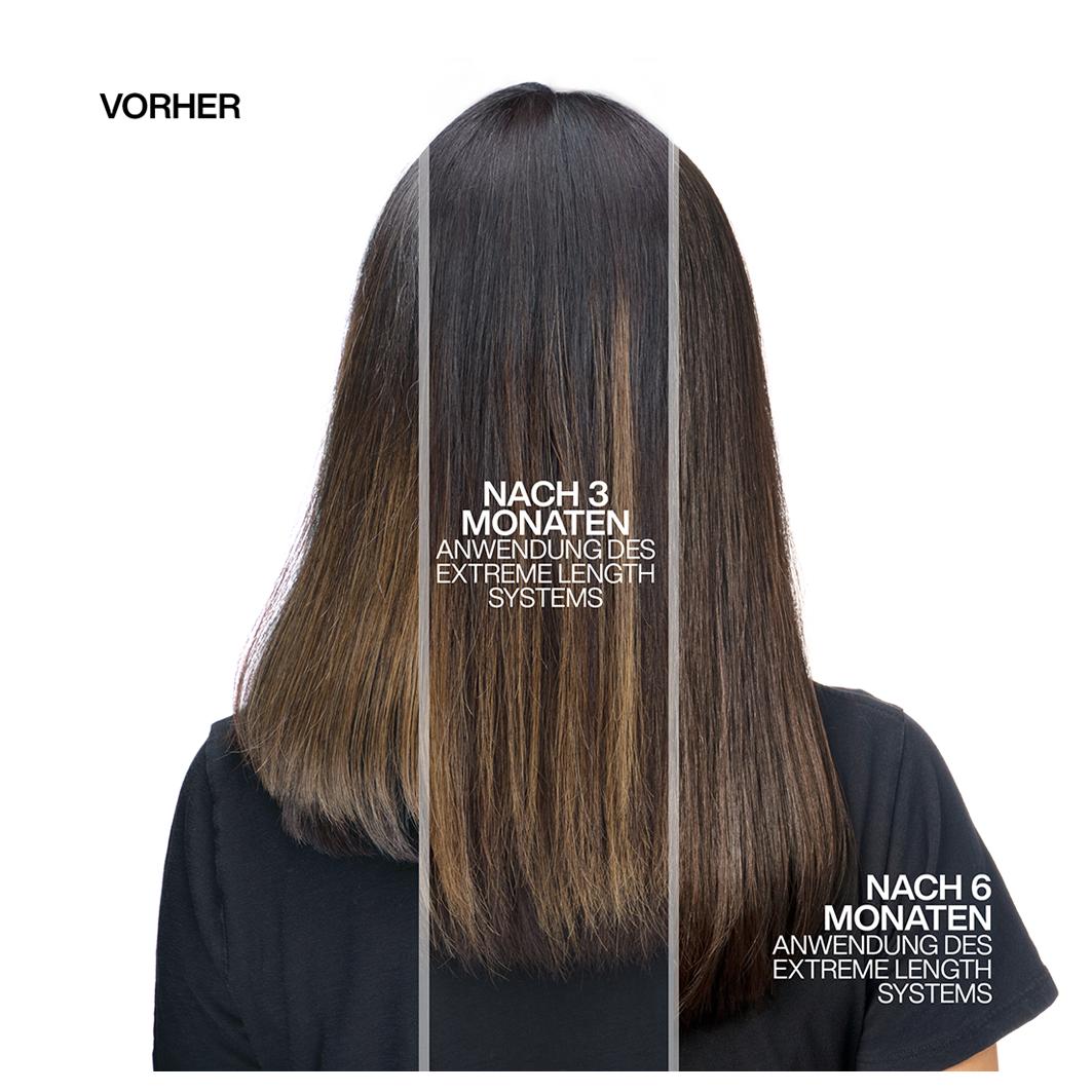 Length Sealer