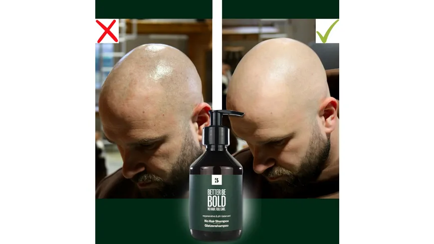 BETTER BE BOLD Pflegendes Glatzenshampoo (0-6mm) 200 ml