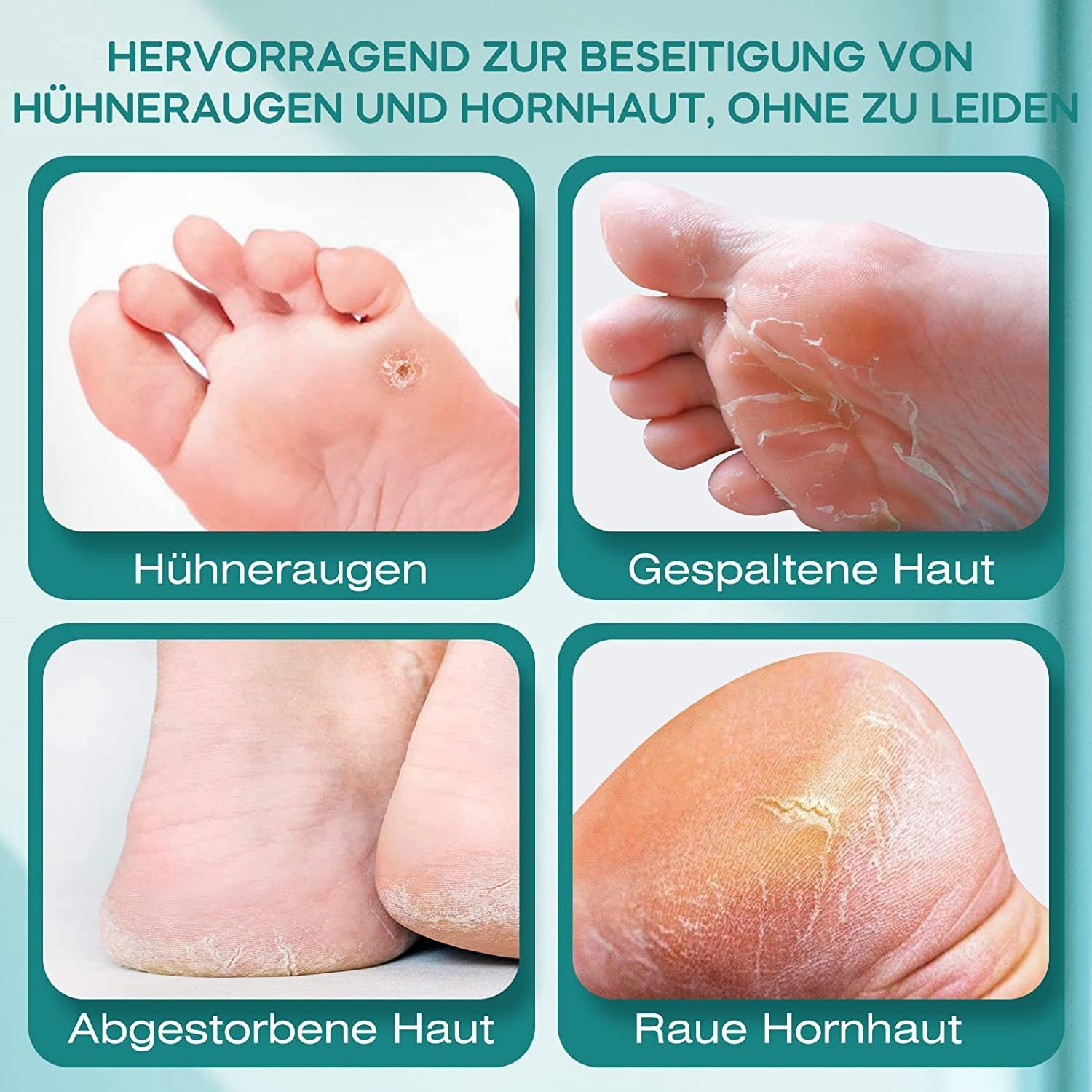 Haiaveng Elektrischer Hornhautentferner Hornhautentferner Elektrisch, Wiederaufladbar Hornhauthobel, für Füsse, Fußpflege Pediküre,Foot File Electric mit 3 Rollen,2 Geschwindigkeiten