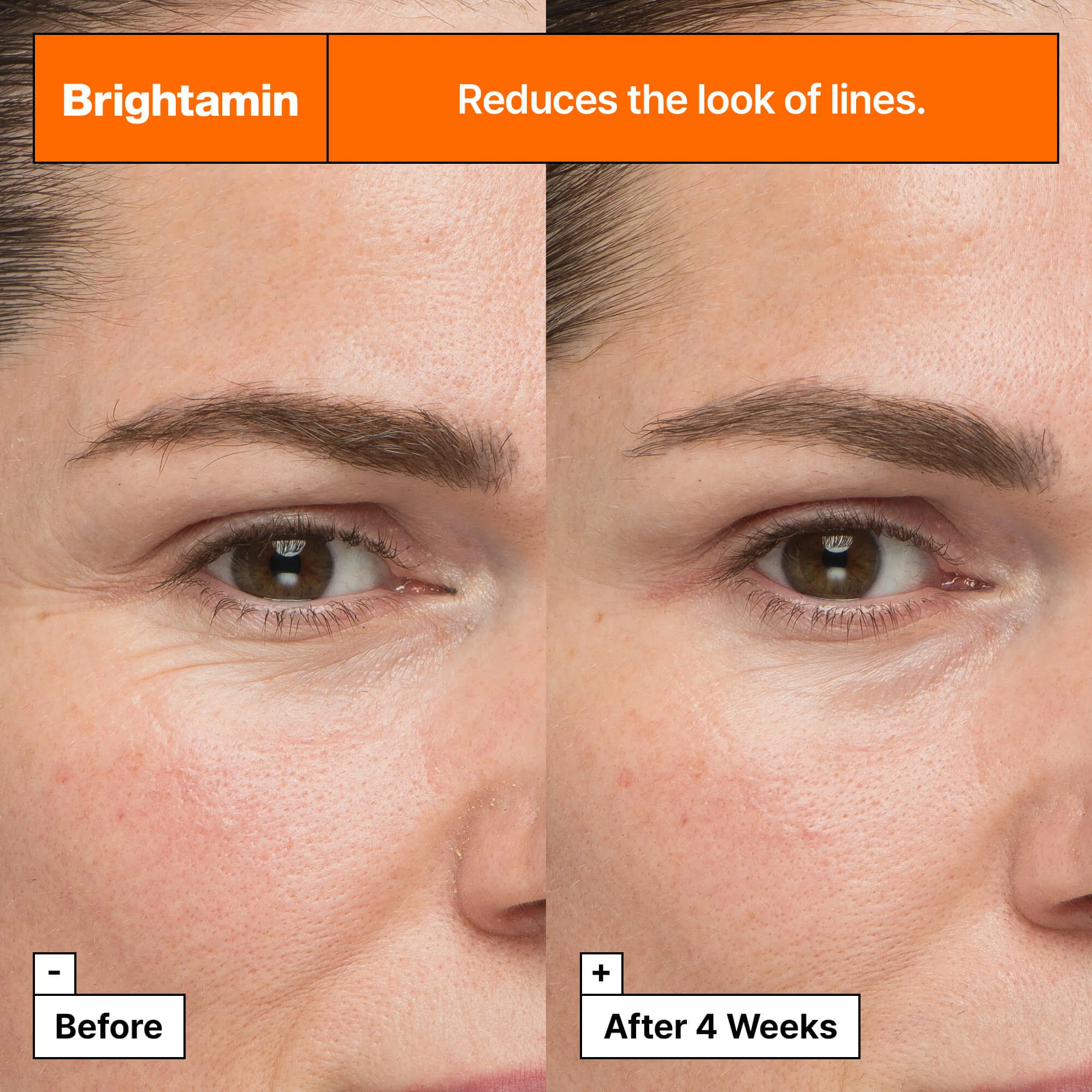 Brightamin Serum Ampoule - Serum za posvjetljivanje lica