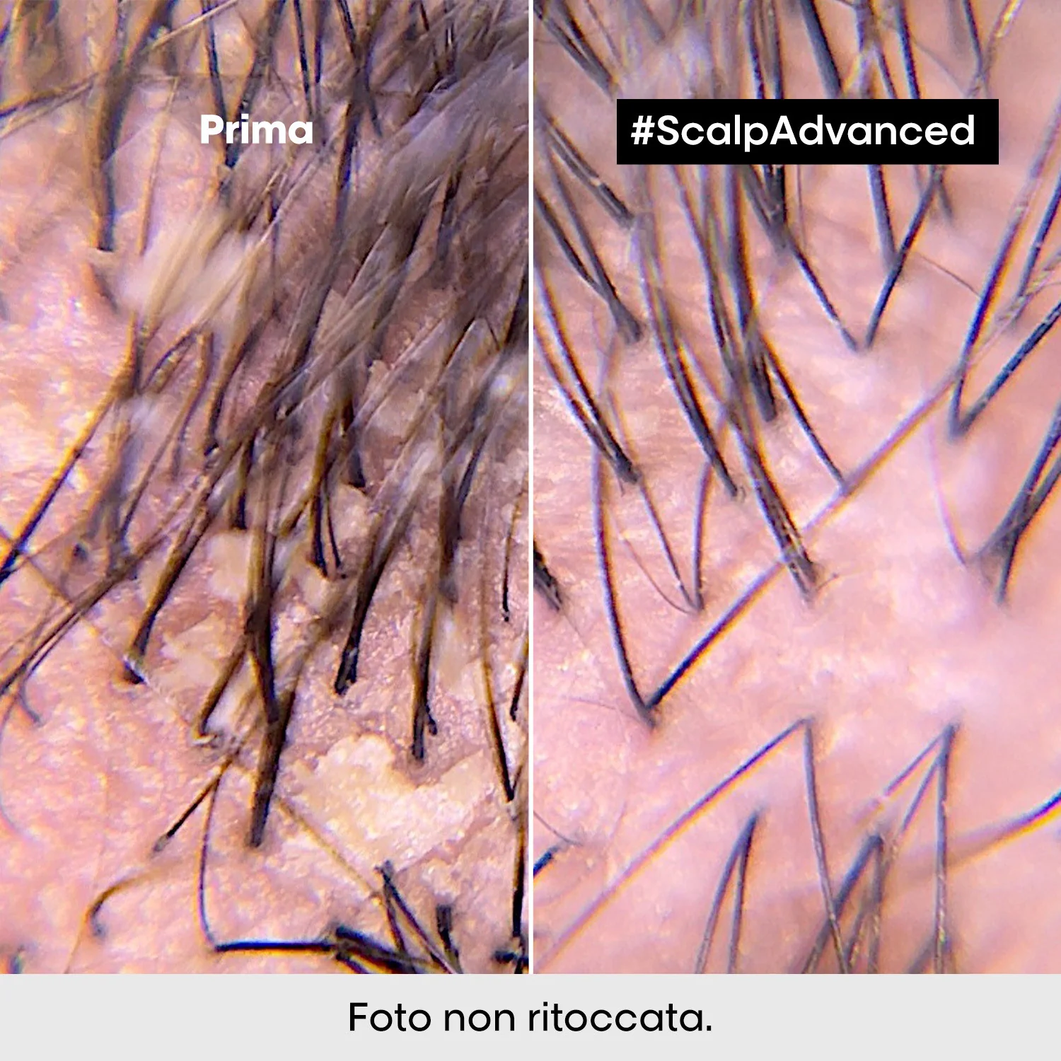 EKSPERTU SĒRIJA New Scalp Advanced Anti-Dandruff Shampoo - Pretblaugznu šampūns